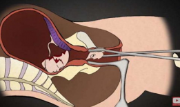 引产手术视频,医学视角下的生命转折